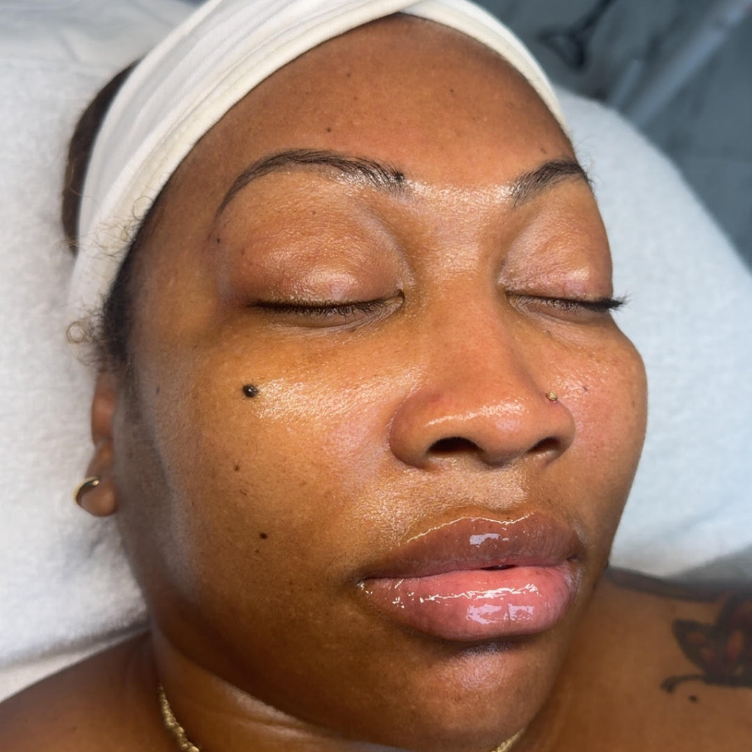 Hydroglow Facial